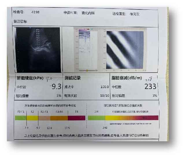 河南肝病医院?郑州哪里的肝病医院效果不错